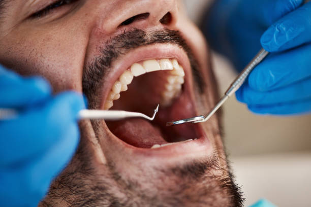 Professional Holistic Dental Care Services in Beattystown, NJ